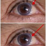 9 Signs of Diabetes That Appear at Night