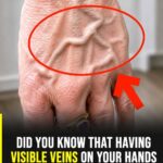 10 Warning Signs of a Blood Clot in the Leg You Should Know