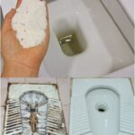 These were my hands 15 days before I started using this homemade remedy.,