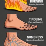 How diabetes and heart disease affect your feet