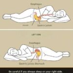 Doctors say there are 12 warning signs of a stroke — and most people only know one of them..
