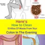 Aneurysm: Signs You Shouldn’t Ignore…..
