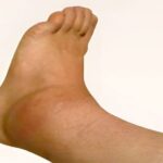 Pharmacist issues warning to anyone who takes Vitamin D