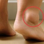 Constipation: Here are 3 natural remedies that facilitate the evacuation of stools according to a dietician