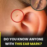 A Month Before a Str.oke, Your Body Warns You: 10 Signs Not to Ignore