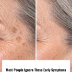 Your body warns you one month before a stroke: 10 signs you shouldn’t ignore