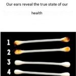 “Put 4 drops in your ear and you will hear like new again!