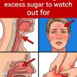 Eight pills you shouldn’t take because they damage your kidneys