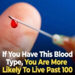 12 Worst Side Effects of Amlodipine You Should NEVER Ignore!