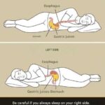 10 Indicators of Blocked Arteries You Shouldn’t Ignore
