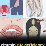 THE MOST POTENT HERB THAT DESTROYS PARASITES, URINARY TRACT & BLADDER INFECTIONS, HERPES, AND FLU VIRUSES