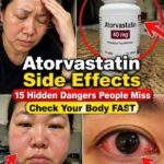 V23 Strange Signs Your Kidneys Might Be in Trouble
