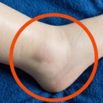 8 Warning Signs of Stroke That May Appear One Month Before and 9 Tips to Prevent It