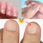 If your veins are visible, it means you are…