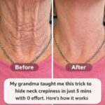 Pfizer admits its Covid vaccines cause a ca…