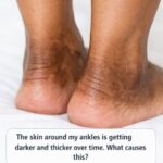 Stroke: These signs that appear one month before.