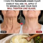 15 Deadly Kidney Signs You Must Catch Early