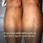Sarcopenia: Causes of muscle loss and solutions