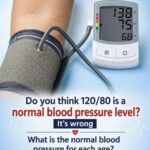 10 Early Warning Signs of a Stroke Everyone Should Know to Take Prompt Action
