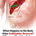 Eight pills you shouldn’t take because they damage your kidneys