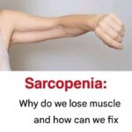 //////After Gallbladder Removal: 3 Conditions You Could Develop — Why You Should Avoid the Surgery When Possible