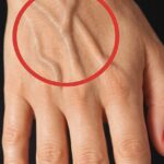 This natural and effective remedy for relieving constipation
