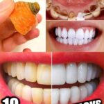 NEVER Use Magnesium If You Are Taking Any of the Following Medications