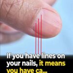 Atorvastatin Side Effects: 15 Hidden Dangers Your Doctor Might Not Tell You About