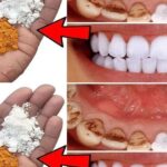 Doctor Uncovers A Telltale Sign In Your Fingernails That May Predict Your Life Expectancy