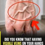 What 10 Subtle Signs Might Your Body Send Weeks Before a Stroke?