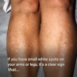 This natural recipe will permanently remove facial hair