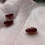 Cholesterol: 5 symptoms that warn you it’s too high(1 / 2)