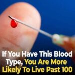 # 8 Warning Signs of Stroke That May Appear One Month Before and 9 Tips to Prevent It
