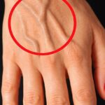 Eight pills you shouldn’t take because they damage your kidneys