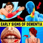 23 Strange Signs Your Kidneys Might Be in Trouble