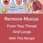 Aneurysm: Signs you shouldn’t ignore… See more