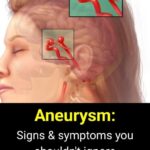 5 Symptoms of a Mini Stroke in Seniors That Shouldn’t Be Ignored